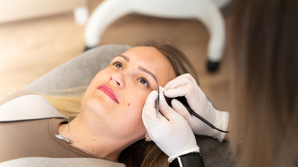 DSC05511-ledi-elektroepilation-neuffen Elektroepilation Gesichtsbehaarung